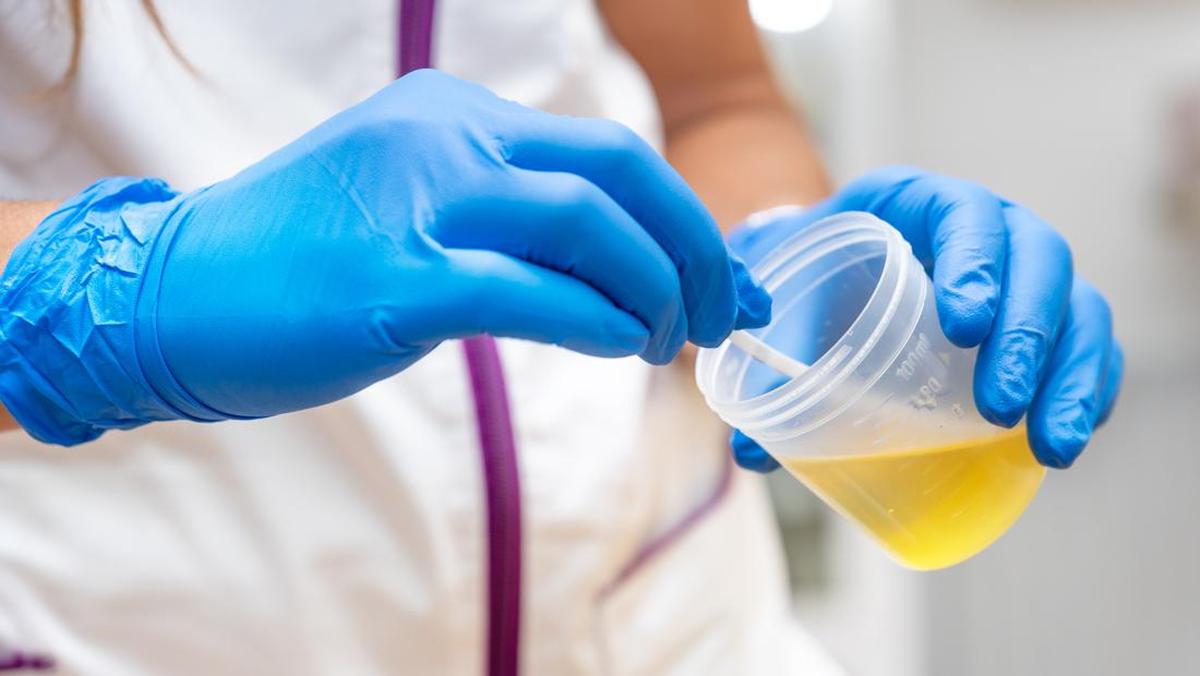 Pakar Kesehatan Ingatkan Urine Jernih Tidak Selalu Menandakan Kesehatan Optimal
