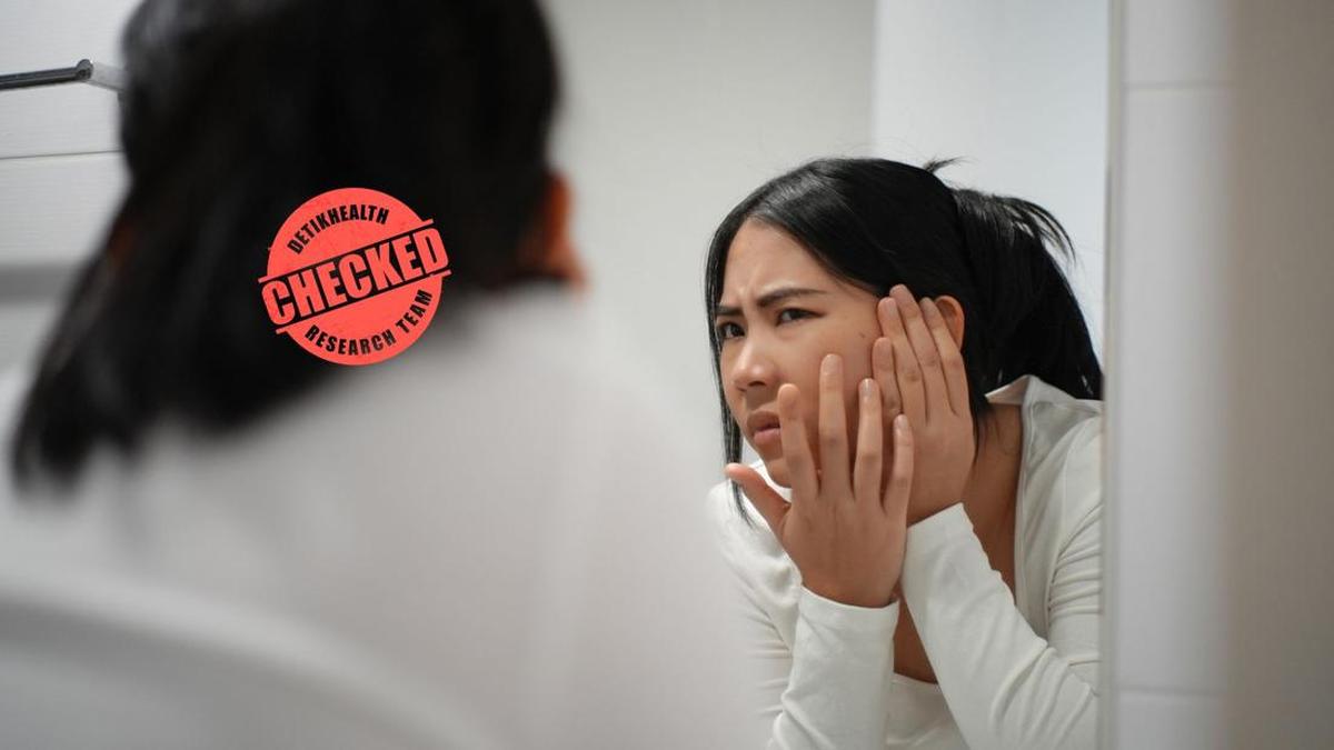 Pola Makan Ternyata Berpengaruh pada Jerawat, Ini Penjelasannya