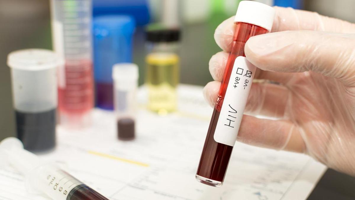 Klarifikasi Dinas Kesehatan Terkait Isu HIV pada Pelajar di Sidoarjo