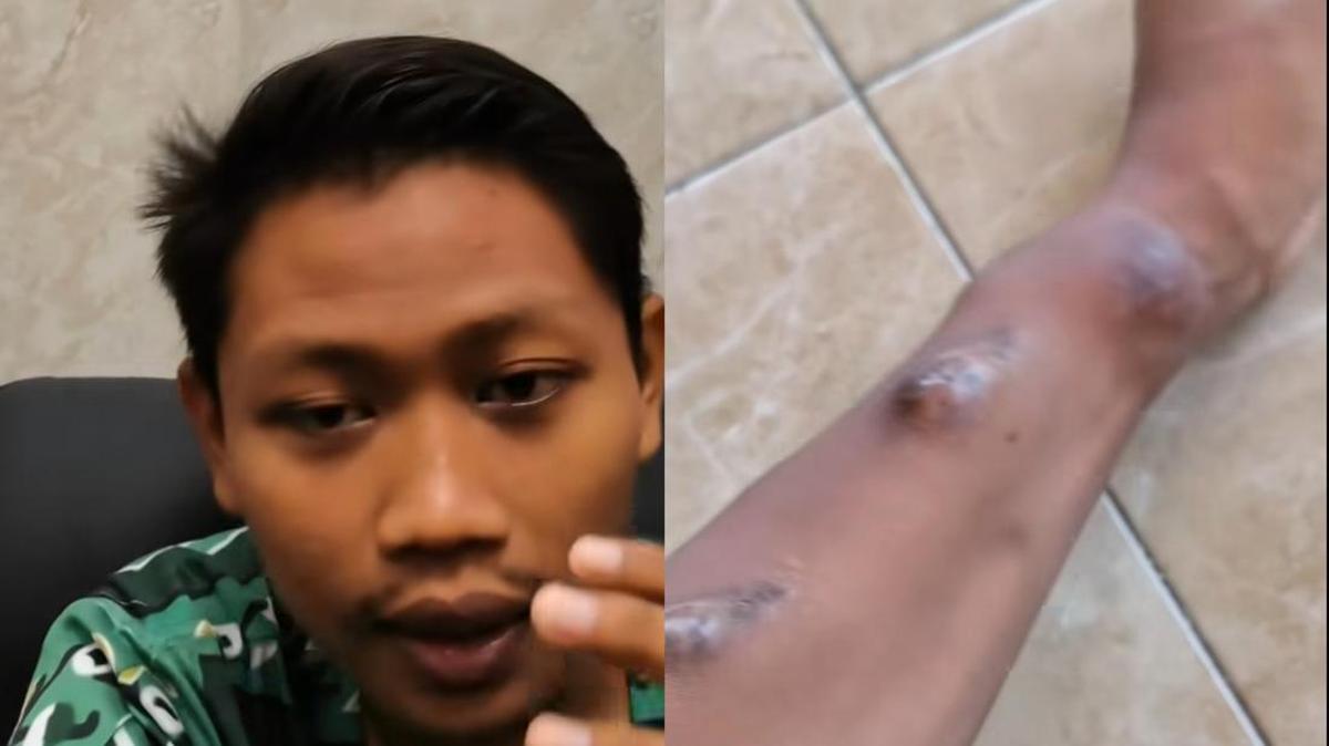 ---
Kisah Edi Utomo: Pria Muda dari Tuban Berjuang Melawan Gagal Ginjal Akibat Kebiasaan Makan Mi Instan

---